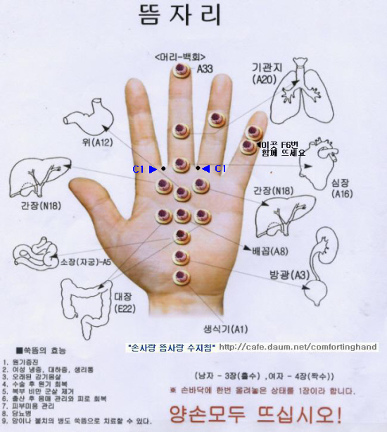 뜸 이미지